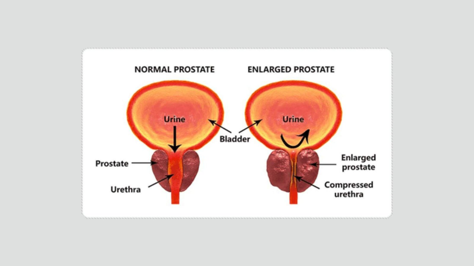 Alpha Force Prostate Formula