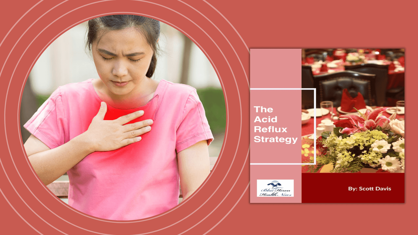 The Acid Reflux Strategy Guide